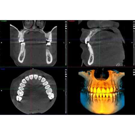 Planmeca ProMax® 3D LEC CBCT Unit - Distributed by Henry Schein