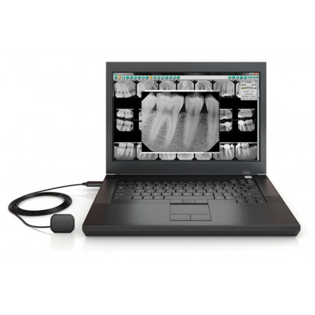 DEXIS Platinum Digital Radiography System | KaVo Kerr - Distributed by Henry Schein