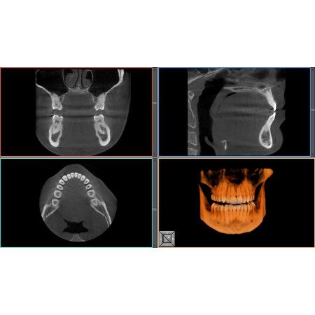 Midmark® Extraoral Imaging System 3D X-Ray, Medium - Distributed by Henry Schein
