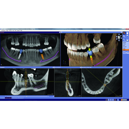 Dentsply Sirona Orthophos SL 3D-i - Ceph Left - Distributed by Henry Schein