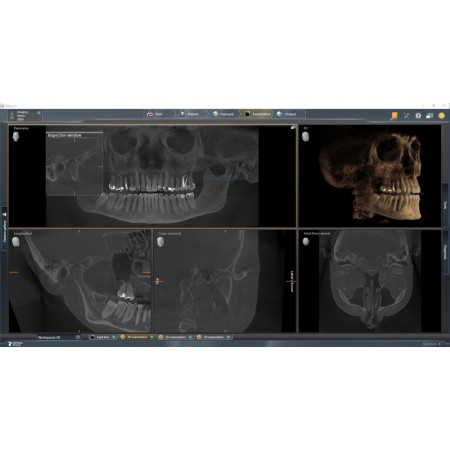 Dentsply Sirona Axeos CBCT Unit - Distributed by Henry Schein