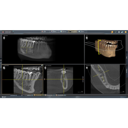 Dentsply Sirona Axeos - Distributed by Henry Schein
