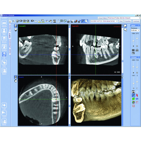 Planmeca ProMax® 3D - Distributed by Henry Schein