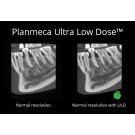 Planmeca Ultra-Low Dose™ Imaging