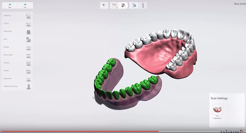 3Shape Implant Studio 2015- How to get started